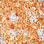S100B Antibody in Immunohistochemistry (Paraffin) (IHC (P))