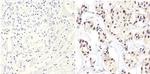 ErbB2 (HER-2) Antibody in Immunohistochemistry (Paraffin) (IHC (P))