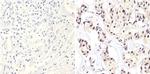 ErbB2 (HER-2) Antibody in Immunohistochemistry (Paraffin) (IHC (P))