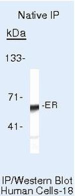 Estrogen Receptor alpha Antibody in Immunoprecipitation (IP)