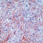EGFR Antibody in Immunohistochemistry (Paraffin) (IHC (P))