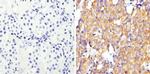 ErbB2 (HER-2) Antibody in Immunohistochemistry (Paraffin) (IHC (P))