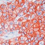 ErbB2 (HER-2) Antibody in Immunohistochemistry (Paraffin) (IHC (P))