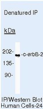 ErbB2 (HER-2) Antibody in Immunoprecipitation (IP)