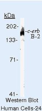 ErbB2 (HER-2) Antibody in Western Blot (WB)