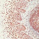Ku70 Antibody in Immunohistochemistry (IHC)