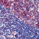 CD35 Antibody in Immunohistochemistry (Paraffin) (IHC (P))