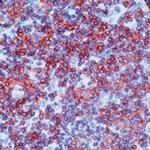 Fyn Antibody in Immunohistochemistry (Paraffin) (IHC (P))