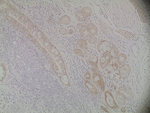 Cytokeratin Pan Type I Antibody in Immunohistochemistry (Paraffin) (IHC (P))