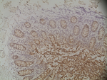 Cytokeratin Pan Type II Antibody in Immunohistochemistry (Paraffin) (IHC (P))