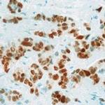 Estrogen Receptor alpha Antibody in Immunohistochemistry (Paraffin) (IHC (P))