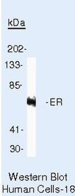 Estrogen Receptor alpha Antibody in Western Blot (WB)