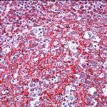 CD45 Antibody in Immunohistochemistry (Paraffin) (IHC (P))