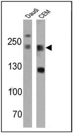 CD45 Antibody in Western Blot (WB)