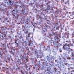 CD79a Antibody in Immunohistochemistry (Paraffin) (IHC (P))