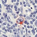 CD30 Monoclonal Antibody (Ber-H2)