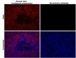 PMEL Antibody in Immunohistochemistry (Paraffin) (IHC (P))