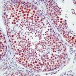 DNA-PK Antibody in Immunohistochemistry (Paraffin) (IHC (P))