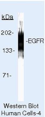 EGFR Antibody in Western Blot (WB)