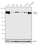 EGFR Antibody in Western Blot (WB)