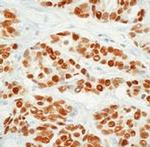 Estrogen Receptor alpha Antibody in Immunohistochemistry (Paraffin) (IHC (P))