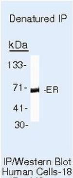 Estrogen Receptor alpha Antibody in Immunoprecipitation (IP)