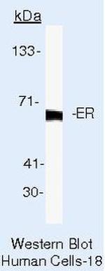 Estrogen Receptor alpha Antibody in Western Blot (WB)