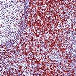 CD5 Antibody in Immunohistochemistry (Paraffin) (IHC (P))