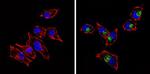 CD68 Monoclonal Antibody (KP1)