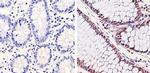 CDK6 Antibody in Immunohistochemistry (Paraffin) (IHC (P))