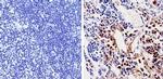 CDK6 Antibody in Immunohistochemistry (Paraffin) (IHC (P))