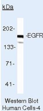 EGFR Antibody in Western Blot (WB)