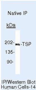 Thrombospondin 1 Antibody in Immunoprecipitation (IP)
