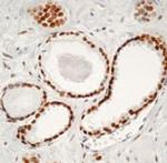 Androgen Receptor Antibody in Immunohistochemistry (IHC)