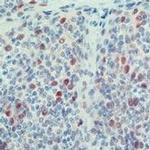 Cdk2 Antibody in Immunohistochemistry (Paraffin) (IHC (P))