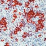 Cdk2 Antibody in Immunohistochemistry (Paraffin) (IHC (P))