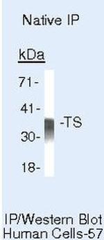 Thymidylate Synthase Antibody in Immunoprecipitation (IP)