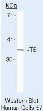 Thymidylate Synthase Antibody in Western Blot (WB)