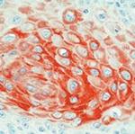 Cytokeratin 17 Antibody in Immunohistochemistry (Paraffin) (IHC (P))