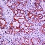 Cytokeratin 17 Antibody in Immunohistochemistry (Paraffin) (IHC (P))