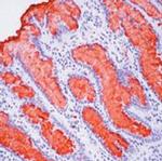 MUC5AC Antibody in Immunohistochemistry (IHC)