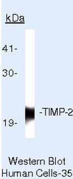 TIMP2 Antibody in Western Blot (WB)