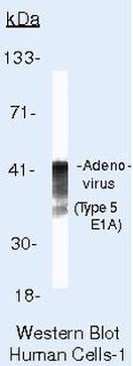 Adenovirus Type 5 Antibody in Western Blot (WB)