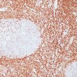Bcl-2 Antibody in Immunohistochemistry (IHC)