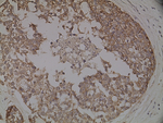 ErbB2 (HER-2) Antibody in Immunohistochemistry (Paraffin) (IHC (P))