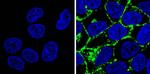 CEA Antibody in Immunocytochemistry (ICC/IF)