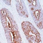 CEA Antibody in Immunohistochemistry (IHC)