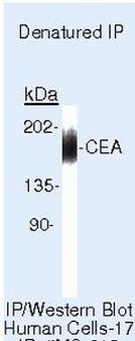 CEA Antibody in Immunoprecipitation (IP)