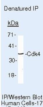 CDK4 Antibody in Immunoprecipitation (IP)