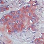 ErbB4 Antibody in Immunohistochemistry (Paraffin) (IHC (P))